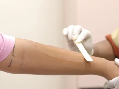 Cooling Gel Application